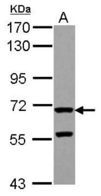 Western Blot: ZP2 Antibody [NBP2-21053]