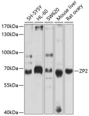 Western Blot: ZP2 AntibodyBSA Free [NBP2-93167]