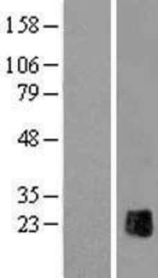 Western Blot: ZP2 Overexpression Lysate [NBL1-18263]