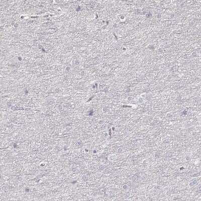 Immunohistochemistry-Paraffin: ZP3 Antibody [NBP2-30830]