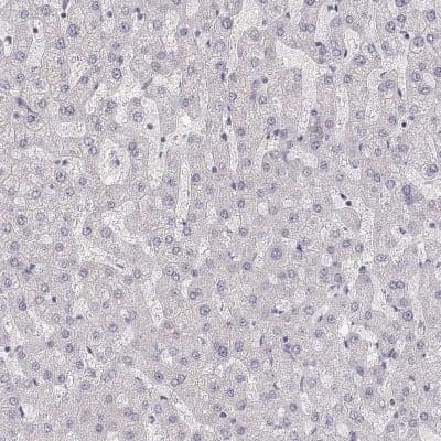 Immunohistochemistry-Paraffin: ZP3 Antibody [NBP2-30830]