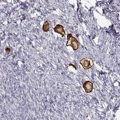 Immunohistochemistry-Paraffin: ZP3 Antibody [NBP2-30830]