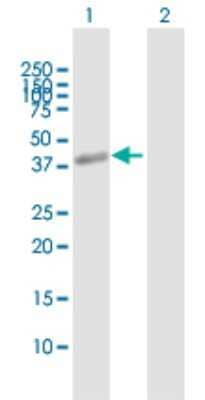 Western Blot: ZP3 Antibody [H00007784-B01P]