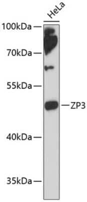 Western Blot: ZP3 AntibodyAzide and BSA Free [NBP2-94499]