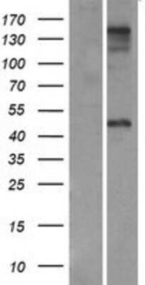 Western Blot: ZP3 Overexpression Lysate [NBP2-07523]