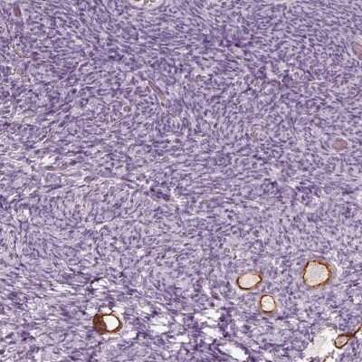 Immunohistochemistry-Paraffin: ZP4 Antibody [NBP1-86823]