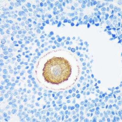 Immunohistochemistry-Paraffin: ZP4 Antibody - Azide and BSA Free [NBP2-94587]