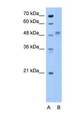 Western Blot: ZP4 Antibody [NBP1-69341]