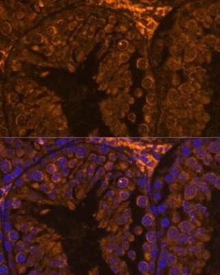 Immunohistochemistry: ZPBP Antibody - Azide and BSA Free [NBP2-93039]