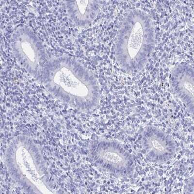 Immunohistochemistry-Paraffin: ZPBP Antibody [NBP2-31726]