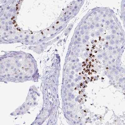 Immunohistochemistry-Paraffin: ZPBP Antibody [NBP2-31726]