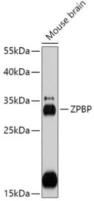 Western Blot: ZPBP AntibodyAzide and BSA Free [NBP2-93039]