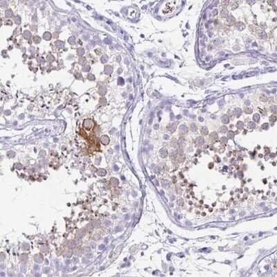 Immunohistochemistry: ZPBP2 Antibody [NBP2-33671]