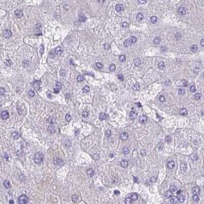 Immunohistochemistry: ZPBP2 Antibody [NBP2-33671]