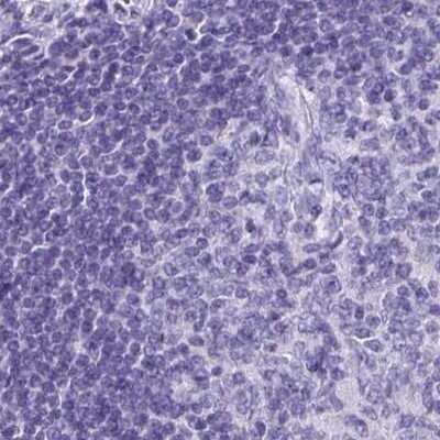 Immunohistochemistry-Paraffin: ZPBP2 Antibody [NBP2-33671]