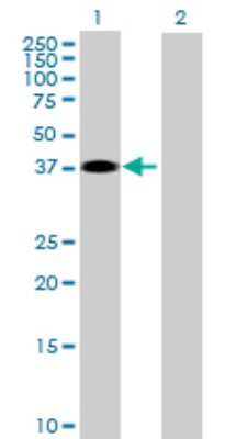 Western Blot: ZPBP2 Antibody [H00124626-B01P]