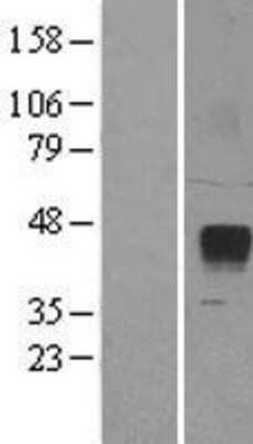 Western Blot: ZPBP2 Overexpression Lysate [NBL1-18265]