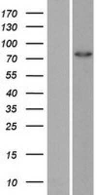 Western Blot: ZRANB1/Trabid Overexpression Lysate [NBP2-06968]