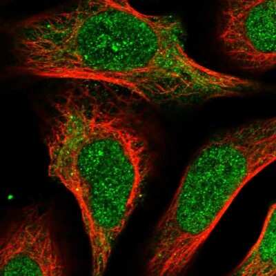 Immunocytochemistry/ Immunofluorescence: ZRANB1/Trabid Antibody [NBP1-86916]