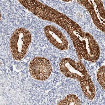 Immunohistochemistry: ZRANB1/Trabid Antibody [NBP1-86917]