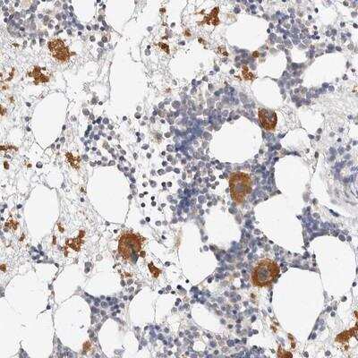 Immunohistochemistry: ZRANB1/Trabid Antibody [NBP1-86918]