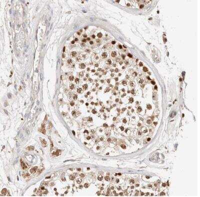Immunohistochemistry-Paraffin: ZRANB1/Trabid Antibody [NBP1-86916]
