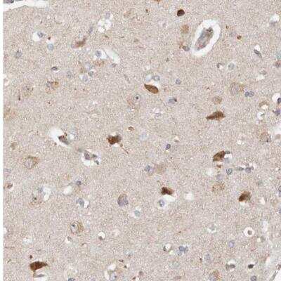 Immunohistochemistry-Paraffin: ZRANB1/Trabid Antibody [NBP1-86916]