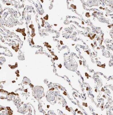 Immunohistochemistry-Paraffin: ZRANB1/Trabid Antibody [NBP1-86916]