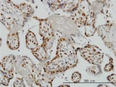 Immunohistochemistry-Paraffin: ZRANB2 Antibody (1D10) [H00009406-M01]