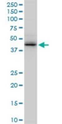 Western Blot: ZRANB2 Antibody (2A11) [H00009406-M02]