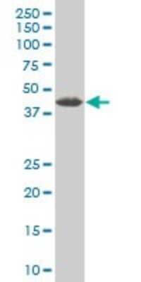 Western Blot: ZRANB2 Antibody (2A11) [H00009406-M02]