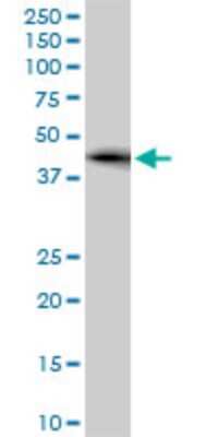 Western Blot: ZRANB2 Antibody (2A11) [H00009406-M02]