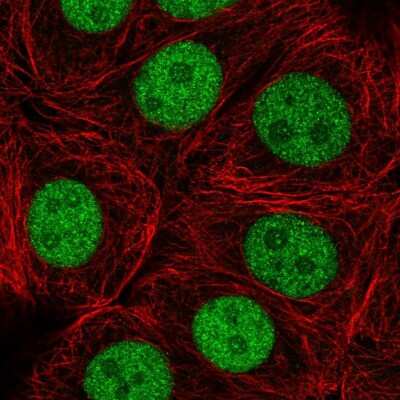 Immunocytochemistry/ Immunofluorescence: ZRANB2 Antibody [NBP2-56264]