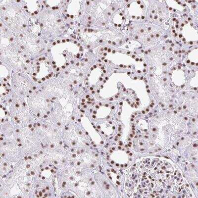 Immunohistochemistry-Paraffin: ZRANB2 Antibody [NBP2-32378]