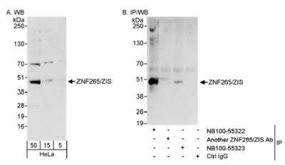 Western Blot: ZRANB2 Antibody [NB100-55322]