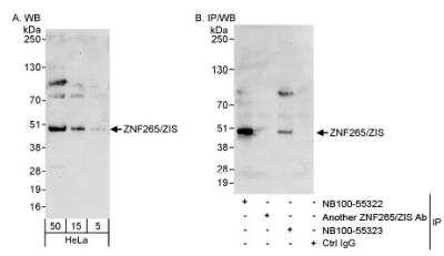 Western Blot: ZRANB2 Antibody [NB100-55323]