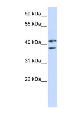 Western Blot: ZRANB2 Antibody [NBP1-57524]