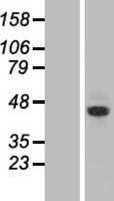 Western Blot: ZRANB2 Overexpression Lysate [NBL1-18266]