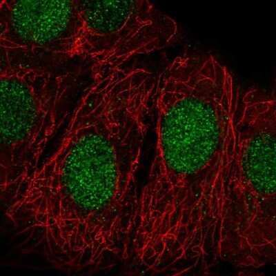 Immunocytochemistry/ Immunofluorescence: ZRANB3 Antibody [NBP2-55227]