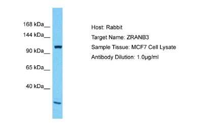 Western Blot: ZRANB3 Antibody [NBP2-86568]