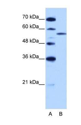 Western Blot: ZRSR2 Antibody [NBP1-57317]