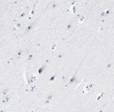 Immunohistochemistry-Paraffin: ZSCAN1 Antibody [NBP1-81978]