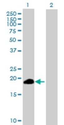 Western Blot: ZSCAN1 Antibody [H00284312-B01P]