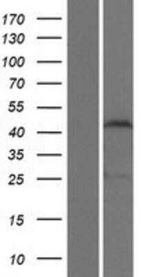 Western Blot: ZSCAN1 Overexpression Lysate [NBP2-04851]