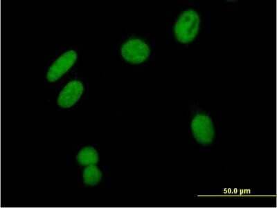 Immunocytochemistry/ Immunofluorescence: ZSCAN16 Antibody [H00080345-B01P]