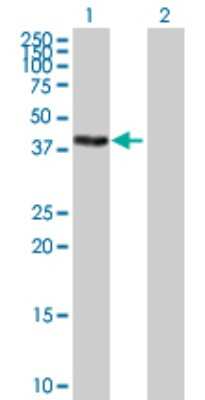 Western Blot: ZSCAN16 Antibody [H00080345-B01P]