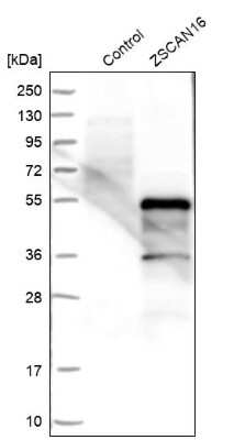 Western Blot: ZSCAN16 Antibody [NBP1-85184]