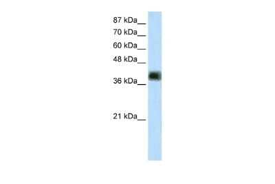 Western Blot: ZSCAN16 Antibody [NBP2-88756]