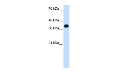 Western Blot: ZSCAN16 Antibody [NBP2-88757]