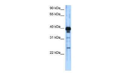 Western Blot: ZSCAN16 Antibody [NBP2-88758]